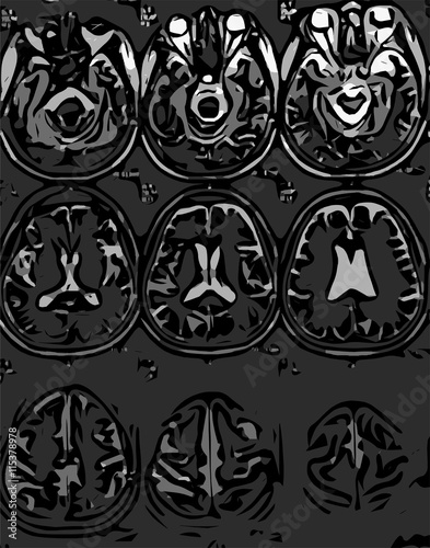 X-ray of human skull