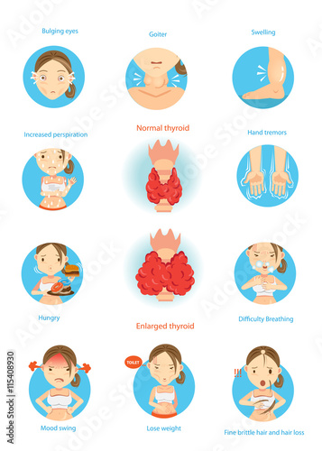 Hyperthyroidism/Symptoms of the disease hyperthyroidism  illustrations in the circle.Cartoon Vector  photo