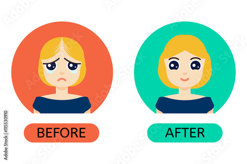 Woman with hair loss problem before and after hair treatment and hair transplantation. Female hair loss set in cartoon style. Perfect for hair clinics and diagnostic centers. Vector illustration.