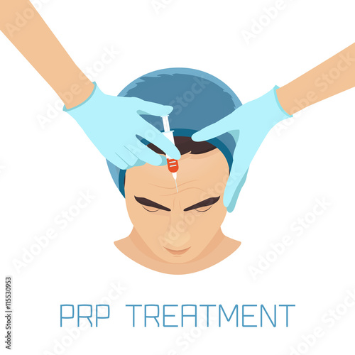 Platelet rich plasma facial injection. PRP therapy process for facelift and wrinkles. Male rejuvenation treatment infographics. Anti-ageing PRP injection procedure. Meso therapy. Vector illustration