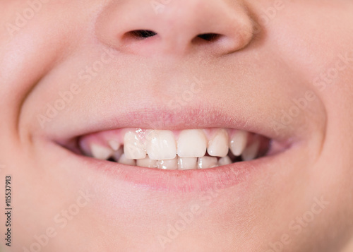 Mouth with white teeth
