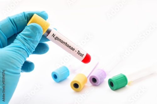 Blood for Neisseria gonorrhoeae test photo