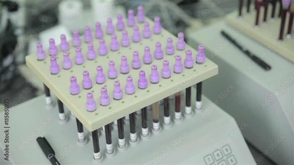 Modern medical automated machine examine test tube with blood samples in medical laboratory. 1080p. Modern medical automated machine examine test tube with blood samples in medical laboratory. 1080p.
