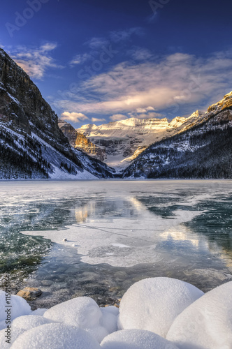 Lake Louise at Daybreak photo