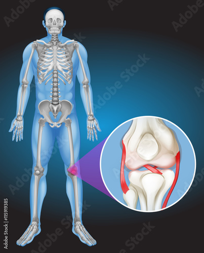 Human body and pain in knee