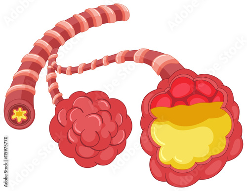 Pneumonia in human lungs
