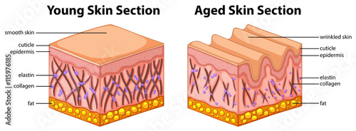 Diagram showing young and aged skin