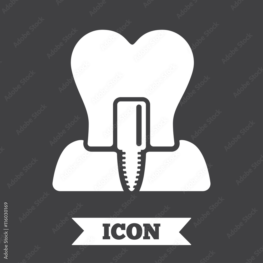 Tooth implant sign icon. Dental care symbol. Tooth implant sign icon. Dental care symbol.