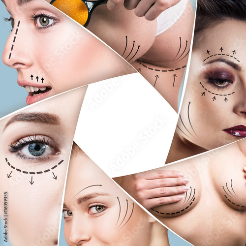 Obraz na plátně Collage of plastic surgery concept