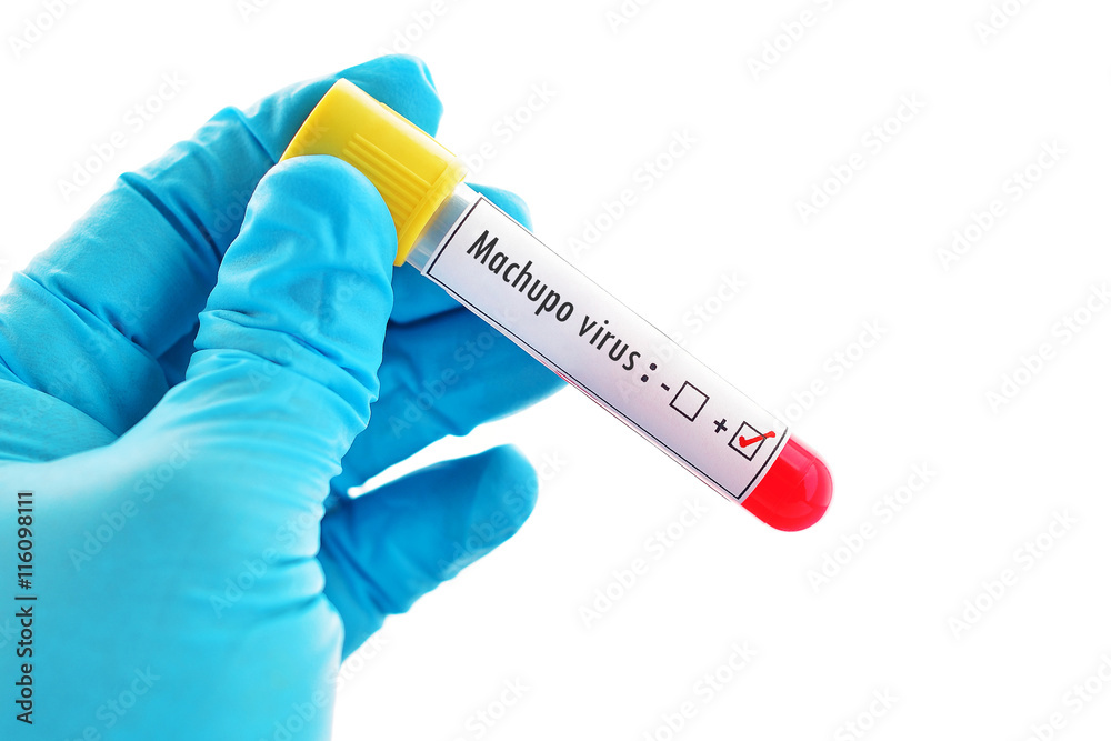 Obraz premium Machupo virus positive