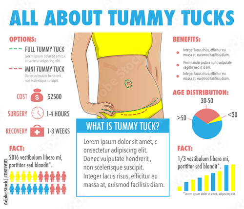 Tummy tuck, abdominoplasty infographic layout for web, posters and brochures. Abdominal or liposuction plastic surgery data template. Closeup of slim female stomach. Vector elements and icons.