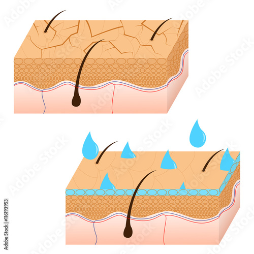 Skin hydration and dry skin sectional view.
