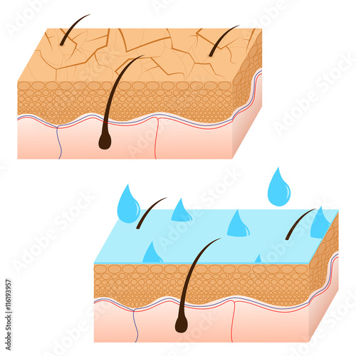 Skin hydration and dry skin sectional view.