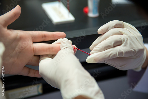 Capillary tube blood collection