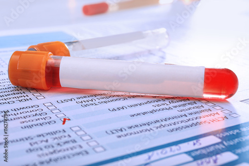 Blood samples on medical re...