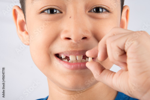 Little boy showing baby teeth toothless close up waiting for new teeth
