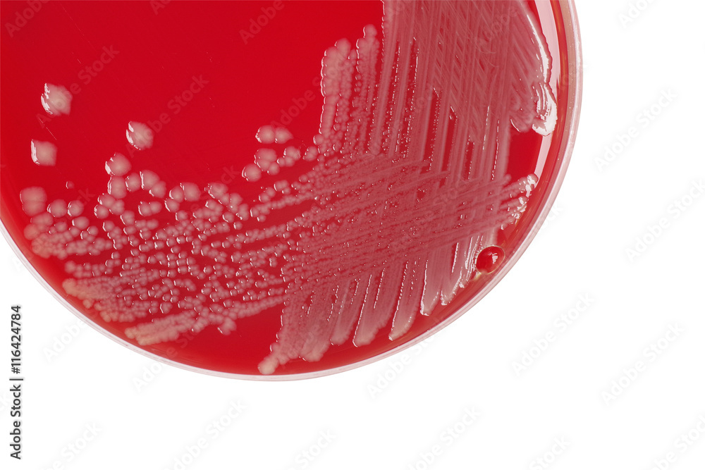 Salmonella enteritidis bacterial colonies on blood agar plate, m Stock