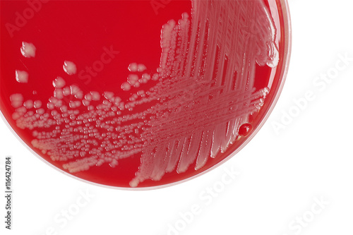 Salmonella enteritidis bacterial colonies on blood agar plate, m photo