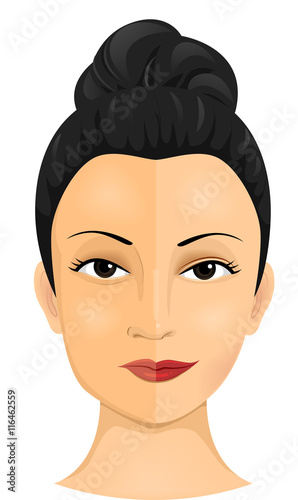Girl Face Cosmetic Surgery
