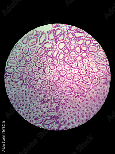 simple epithelial cell of kidney