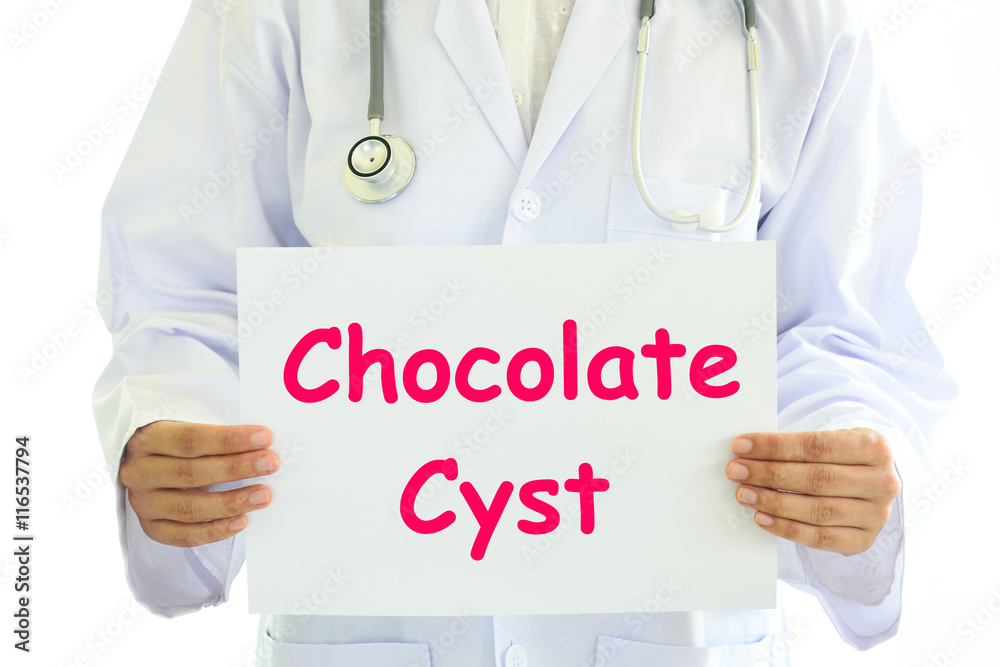 Doctor holding chocolate cyst card in hands Doctor holding chocolate cyst card in hands