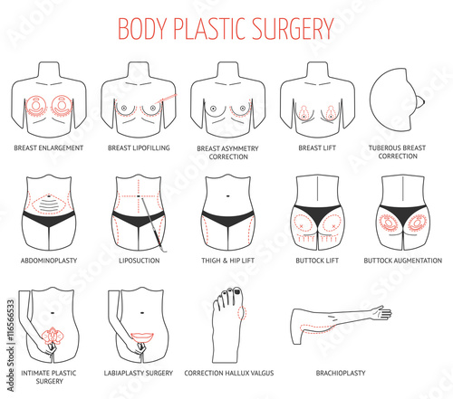 Set of black line body plastic surgery icons. Flat design. Vector photo