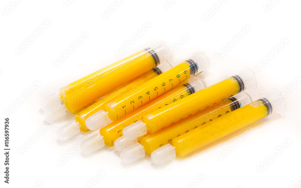 syrings of fat for do fat grafting syrings of fat for do fat grafting