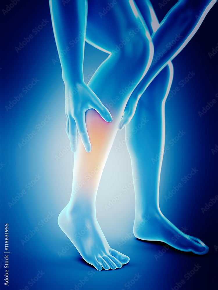 medically accurate 3d illustration of calf pain medically accurate 3d illustration of calf pain