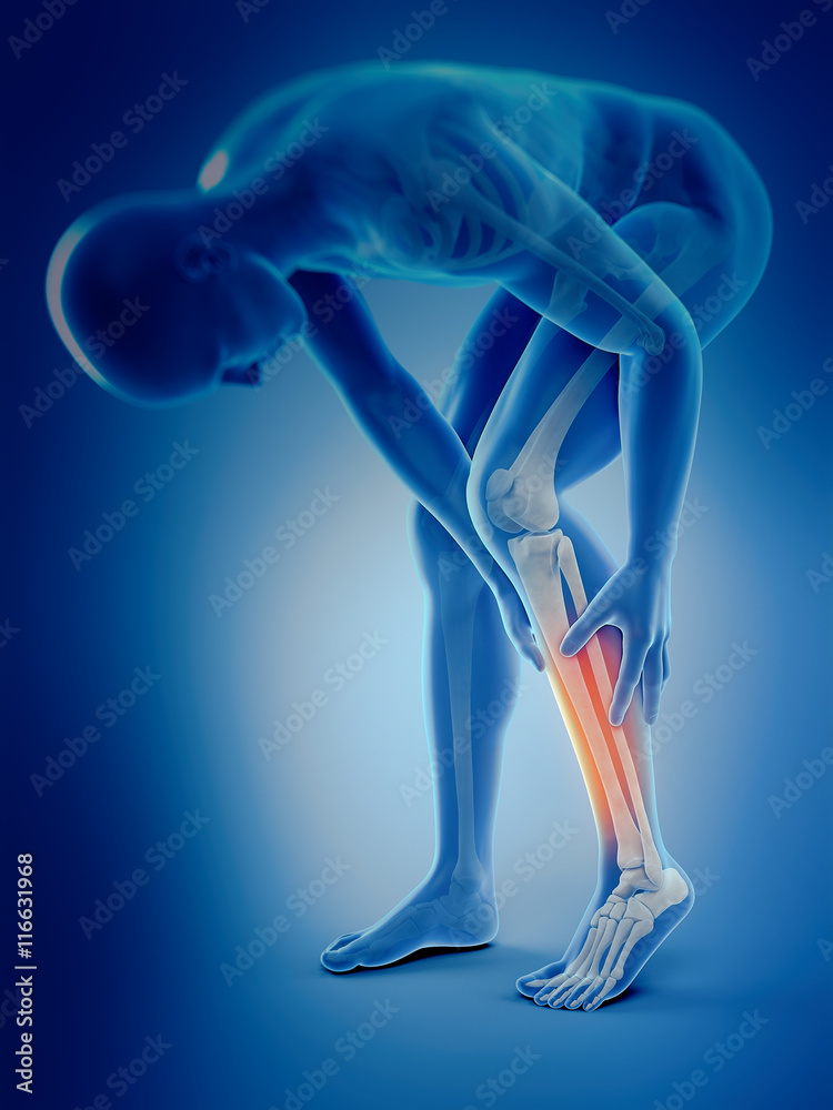 medically accurate 3d illustration of calf pain medically accurate 3d illustration of calf pain
