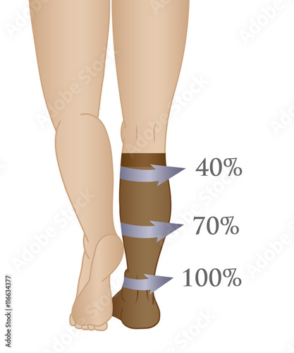 Medical compression hosiery