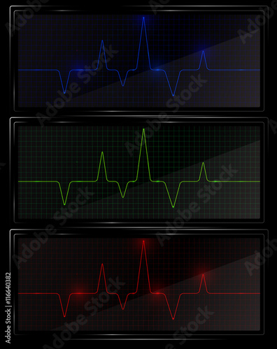 Heart pulse graphic. Vector illustration.