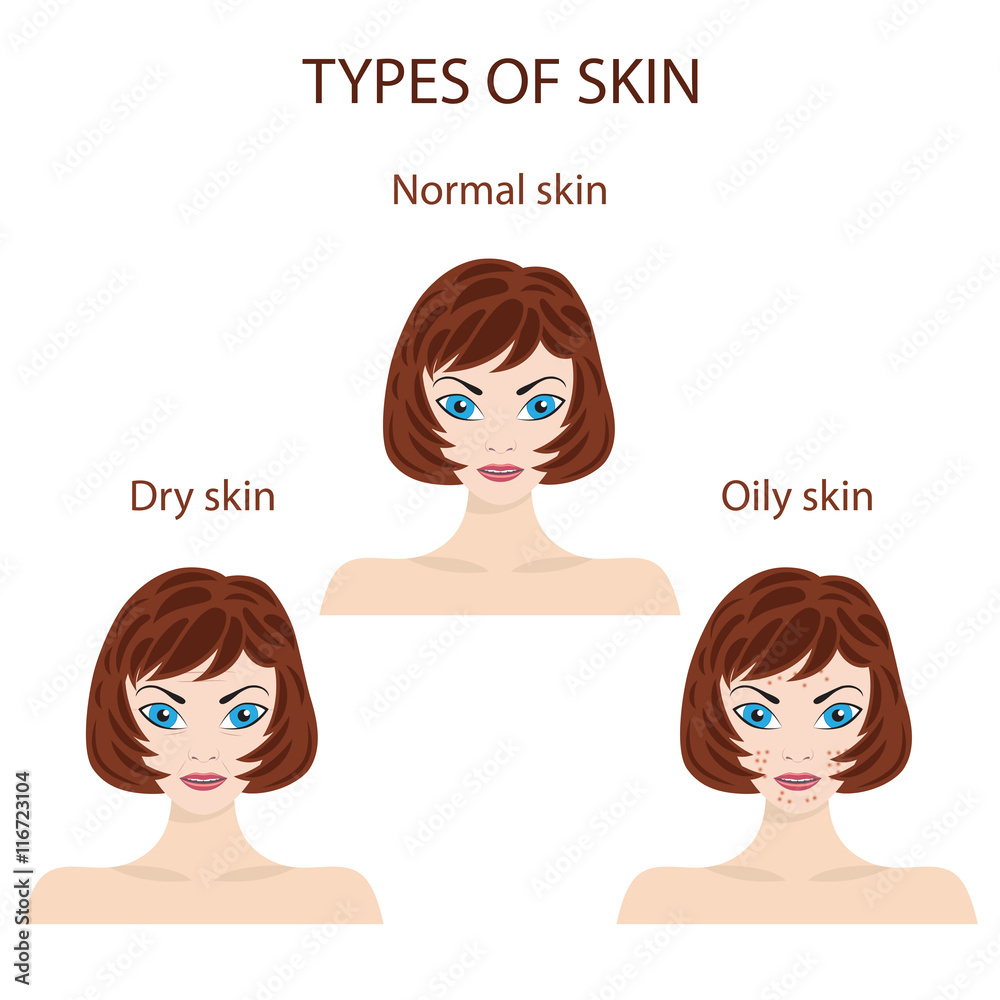 Plakat Types of skin. Oily, normal and dry.