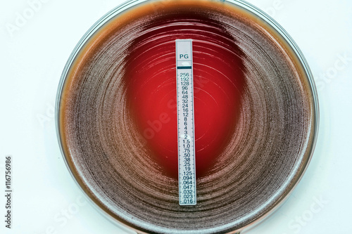 E-test penicillin for staphylococcus aureus/staphylococcus coagu