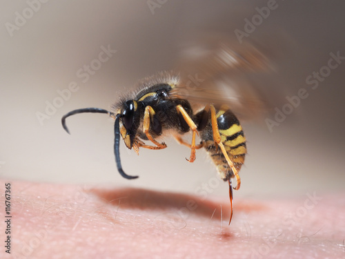 Fényképezés Wasp sting pulls out of human skin. macro