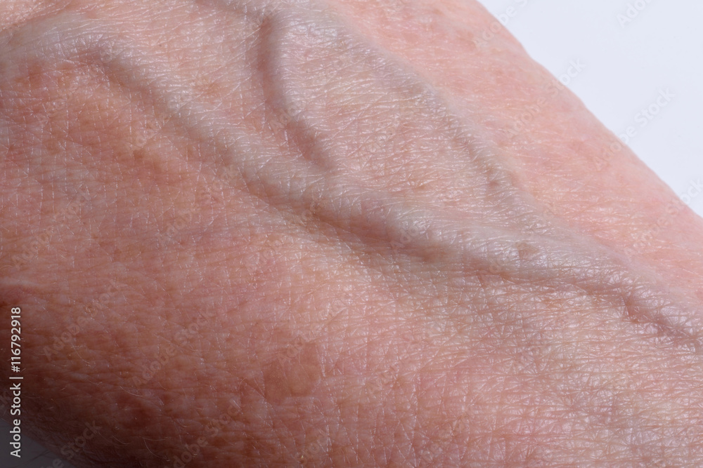 veins on the wrist of an older woman