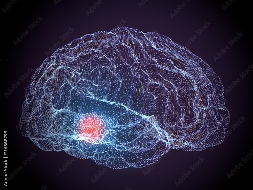 Cervello malattie degenerative Parkinson Cervello malattie degenerative Parkinson