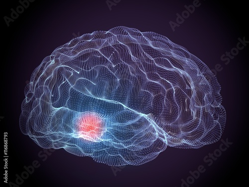 Cervello malattie degenerative Parkinson photo