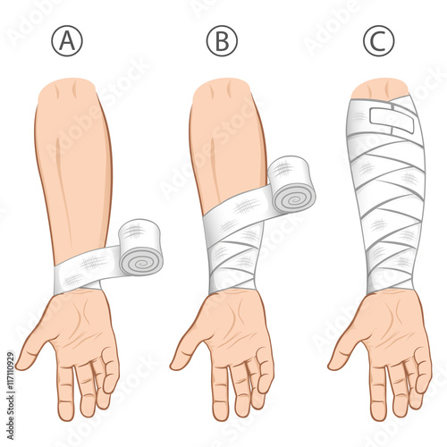 first aid forearm caucasiaon, educational simple dressing