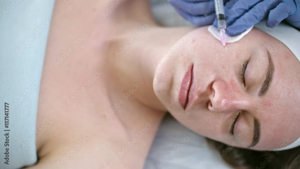 Closeup of hands of therapist making facial collagen injections for young woman