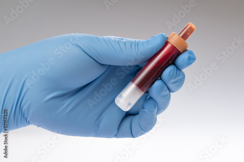 Blut, Blutprobe im test Röhrchen Blutuntersuchung