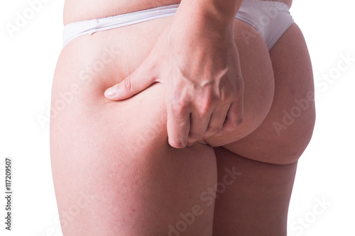 Woman in white panties with cellulite on her ass