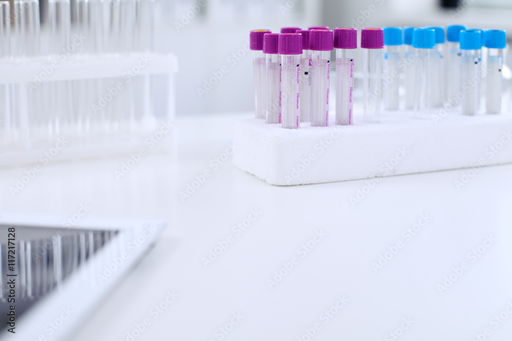Research laboratory working space. Test tubes and tablet PC are lying at the table. Medical equipment. Blood test Research laboratory working space. Test tubes and tablet PC are lying at the table. Medical equipment. Blood test