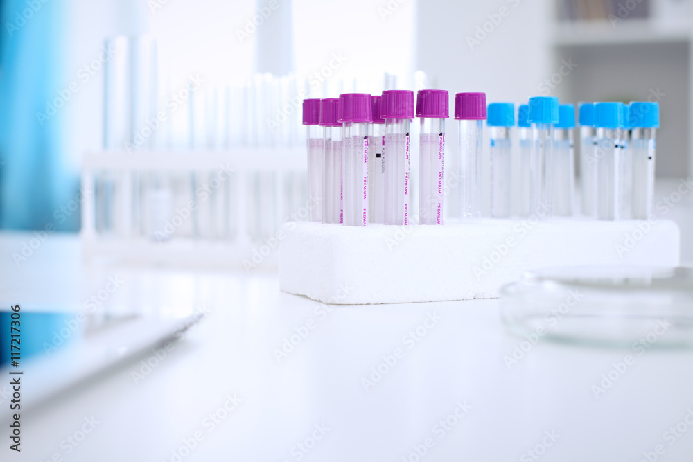 Research laboratory working space. Test tubes and tablet PC are lying at the table. Medical equipment. Blood test Research laboratory working space. Test tubes and tablet PC are lying at the table. Medical equipment. Blood test