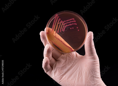 Laboratory doctor hand with sterile glove holding petri dish infected with Yersinia bacteria