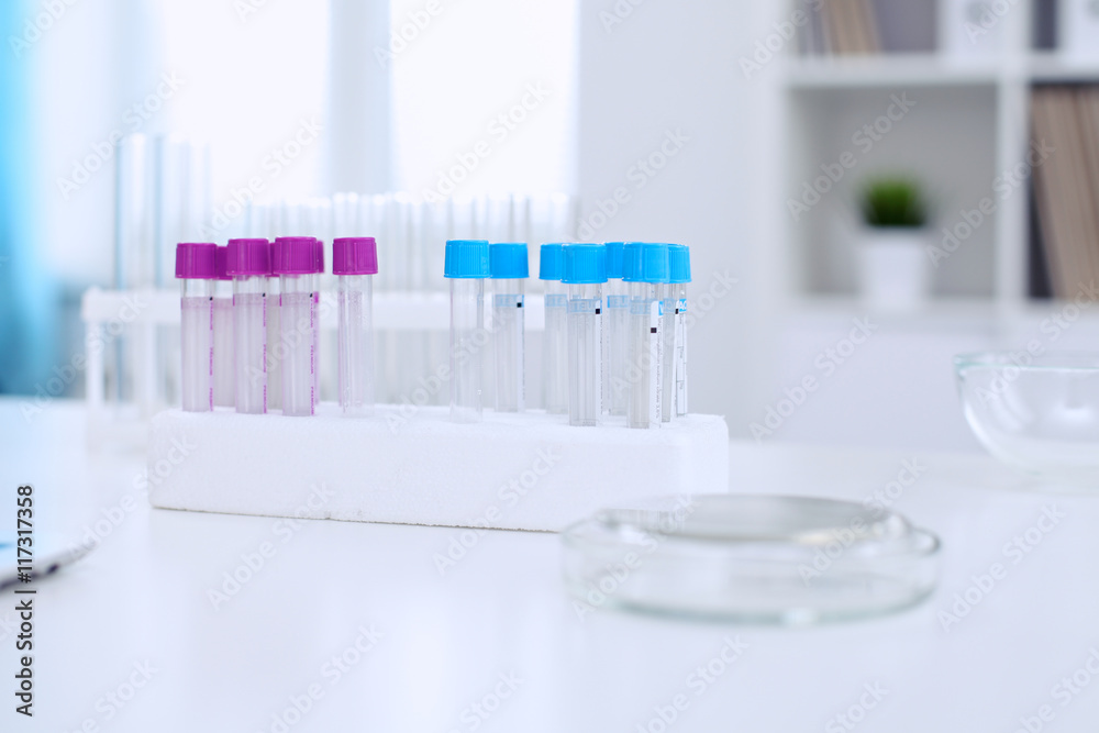 Research laboratory working space. Test tubes and tablet PC are lying at the table. Medical equipment. Blood test Research laboratory working space. Test tubes and tablet PC are lying at the table. Medical equipment. Blood test