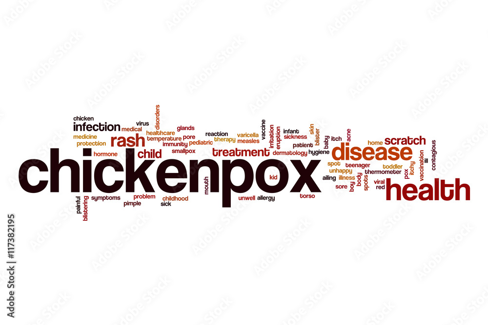 Chickenpox word cloud concept