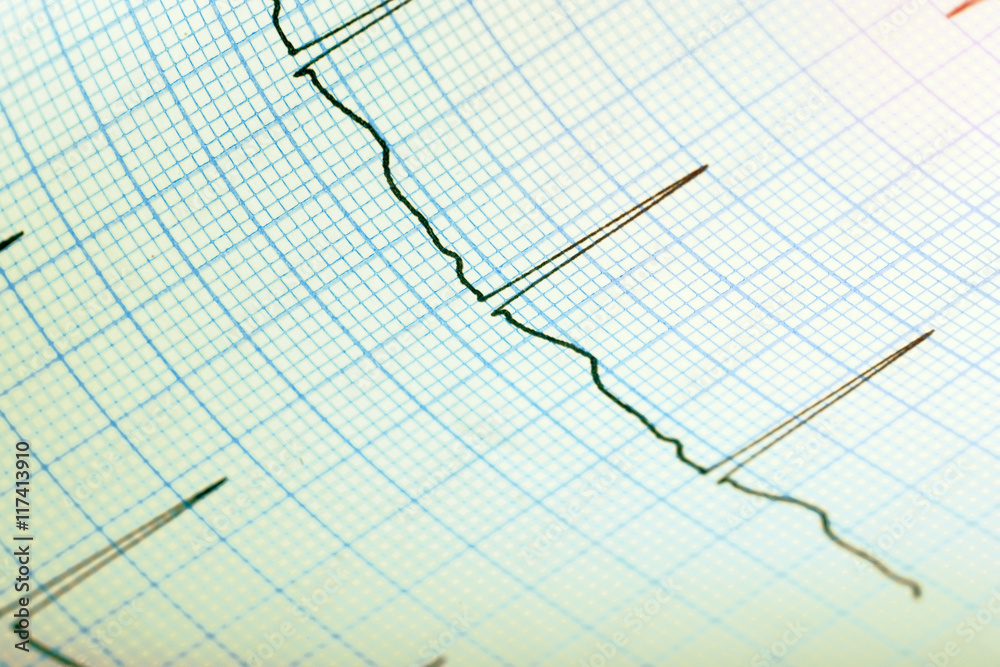 ECG record paper medical background ECG record paper medical background