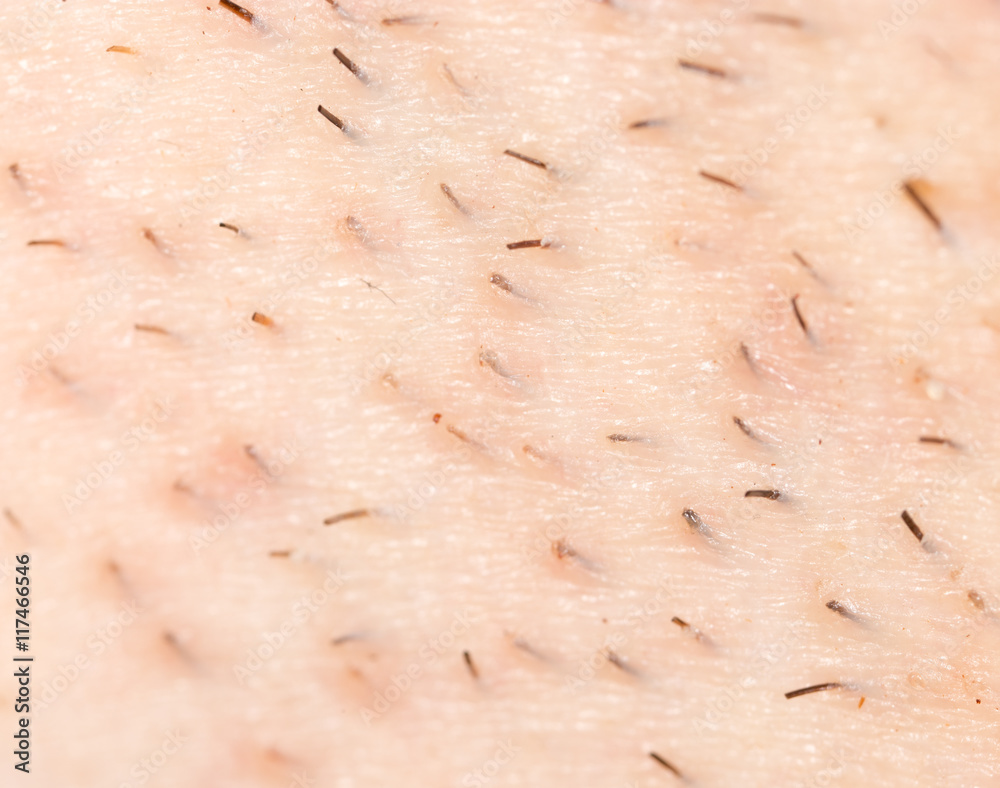 Fototapeta premium the bristles on the skin. macro