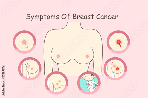 woman breast cancer concept