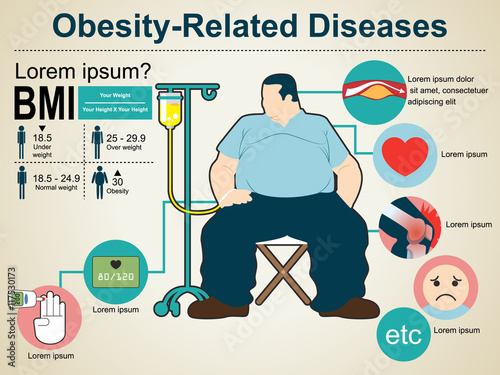 obesity-related diseases info graphics.